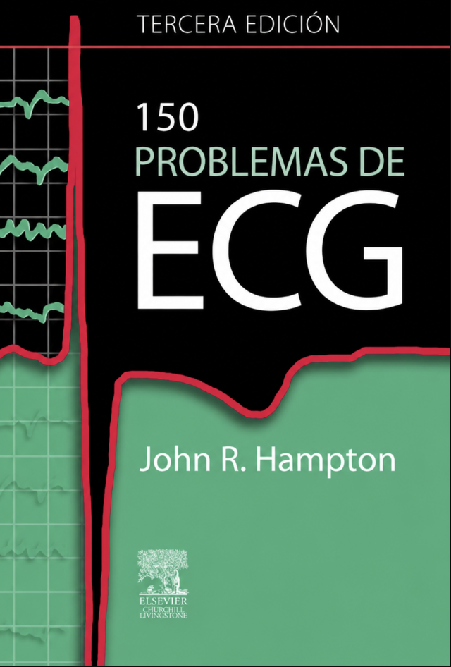 150 problemas de ECG
