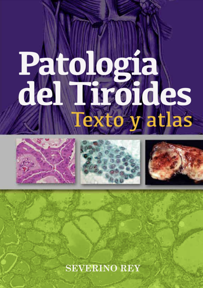 Patología de la glándula tiroides Texto y Atlas (Digital)