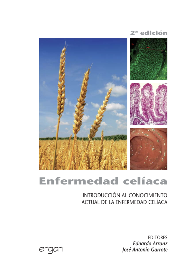 Enfermedad celíaca: introducción al conocimiento actual de la enfermedad celíaca