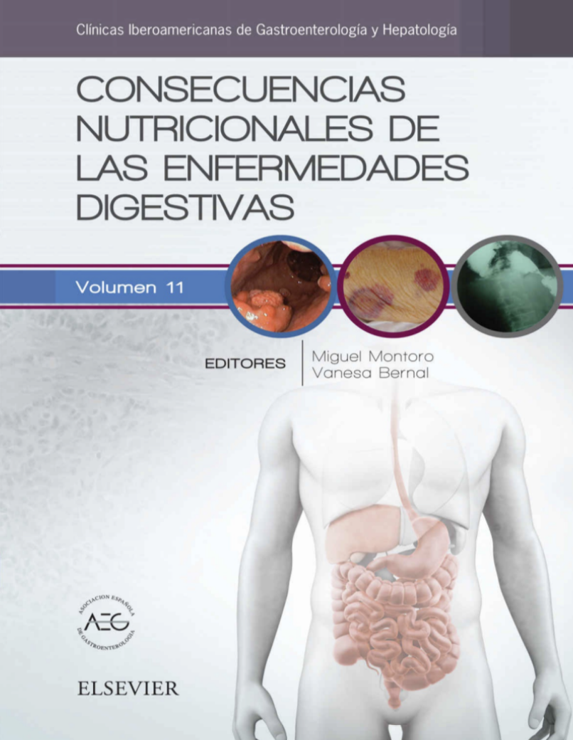 Consecuencias nutricionales de las enfermedades digestivas