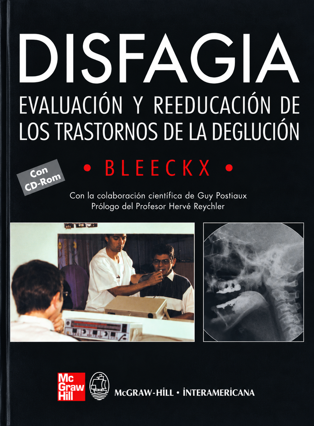 Disfagia: evaluación y reeducación de los trastornos de la deglución
